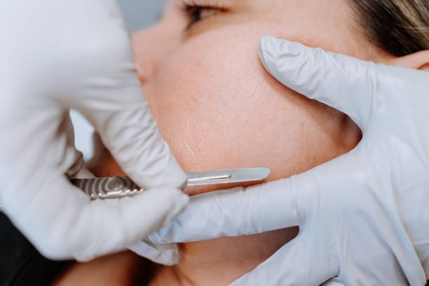 Dermaplaning Facial - 60 Minutes