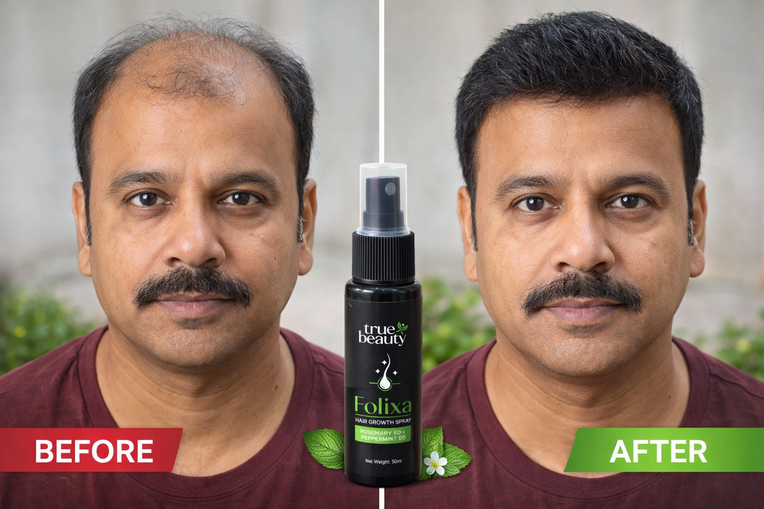 Folixa Hair Growth Spray