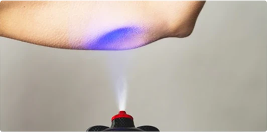 Cellulite Reduction $100-250 PRICE PER TREATMENT