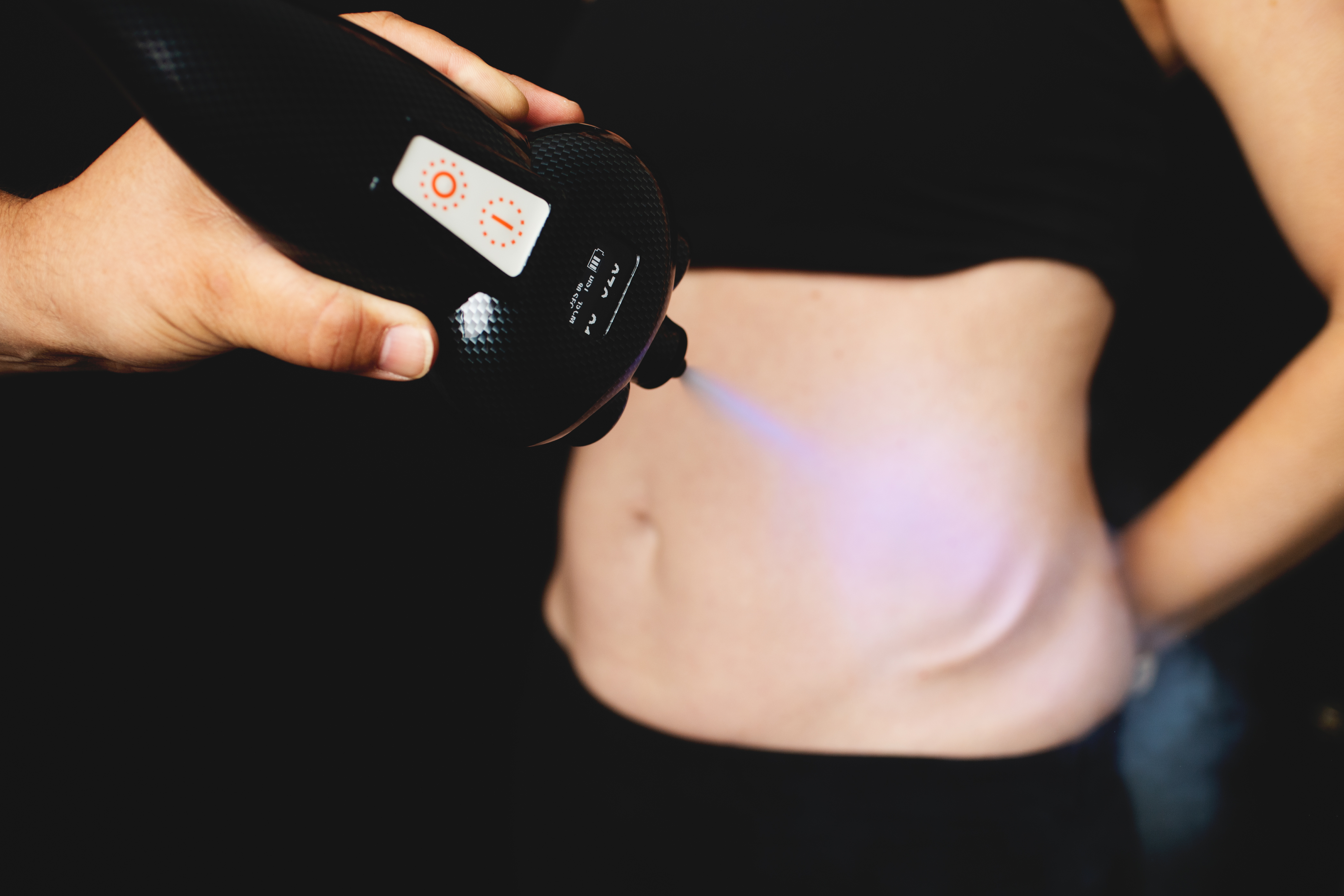 FAT LOSS - $75-350 PRICE PER TREATMENT