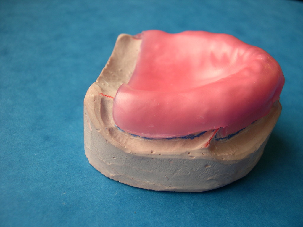 ACRILICO AUTOPOLIMERIZABLE