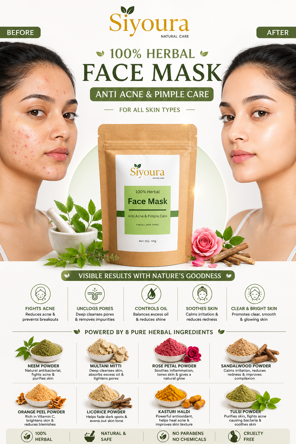 Anti Acne & Pimple Care Face Mask | 100% Herbal Face Mask | 50g