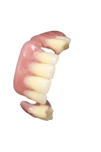 Prótesis parcial de 6 a 9 piezas 