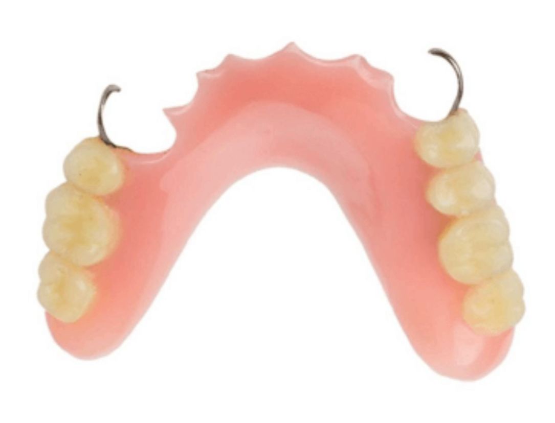 Prótesis parcial de  1 a 5 piezas 