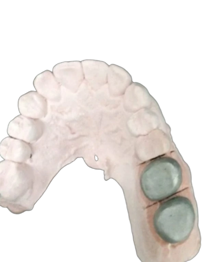 Estructura metálica por unidad 