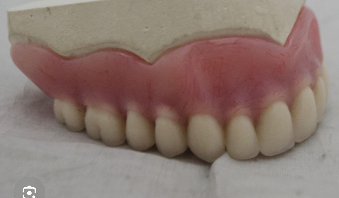 Prótesis total alto impacto 