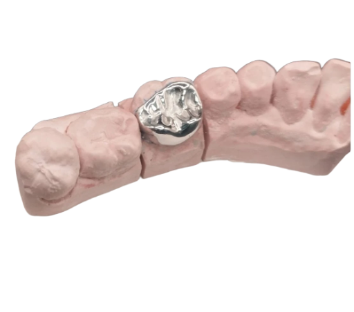 Incrustación metálica 