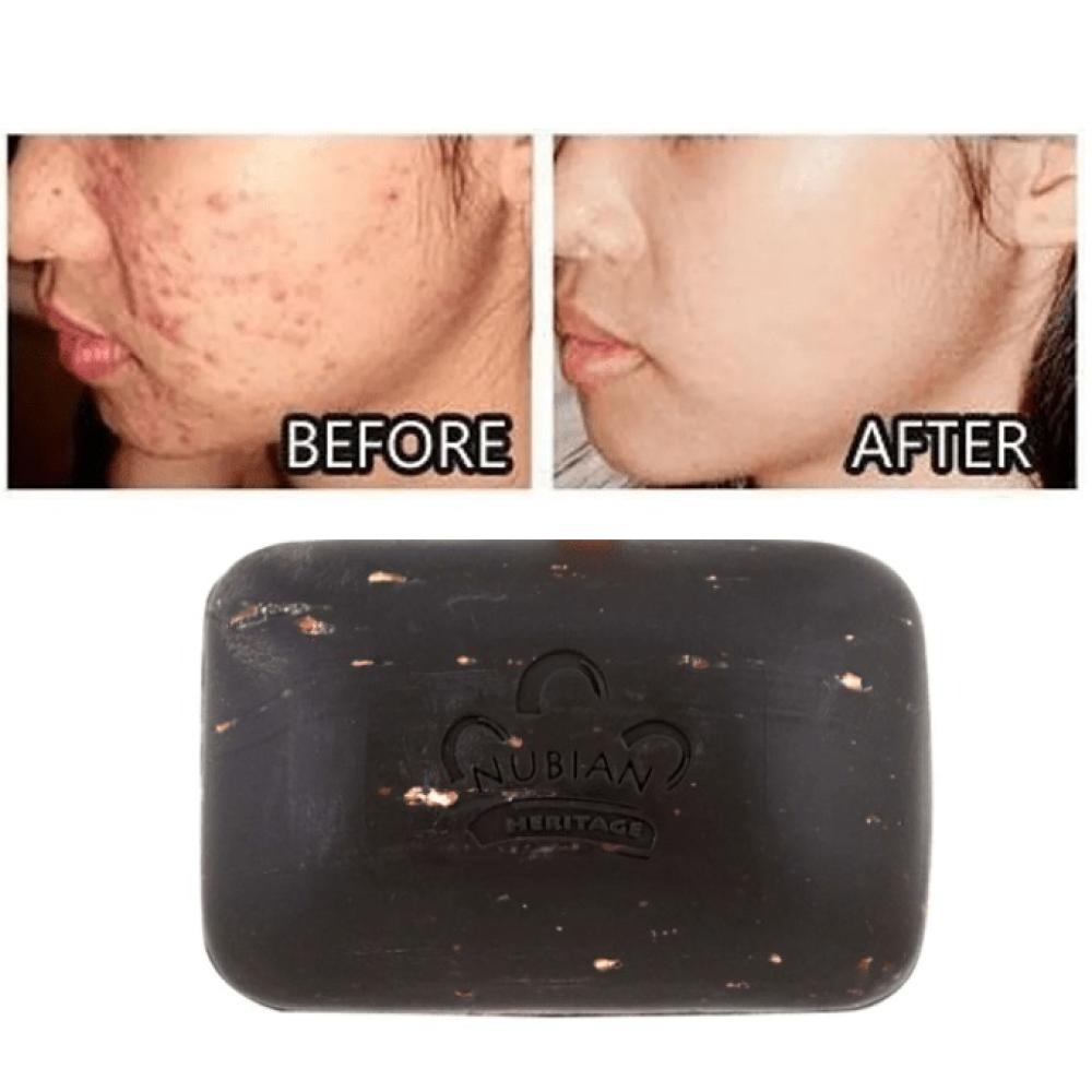 African Black Soap Bar natural detox cleanse 