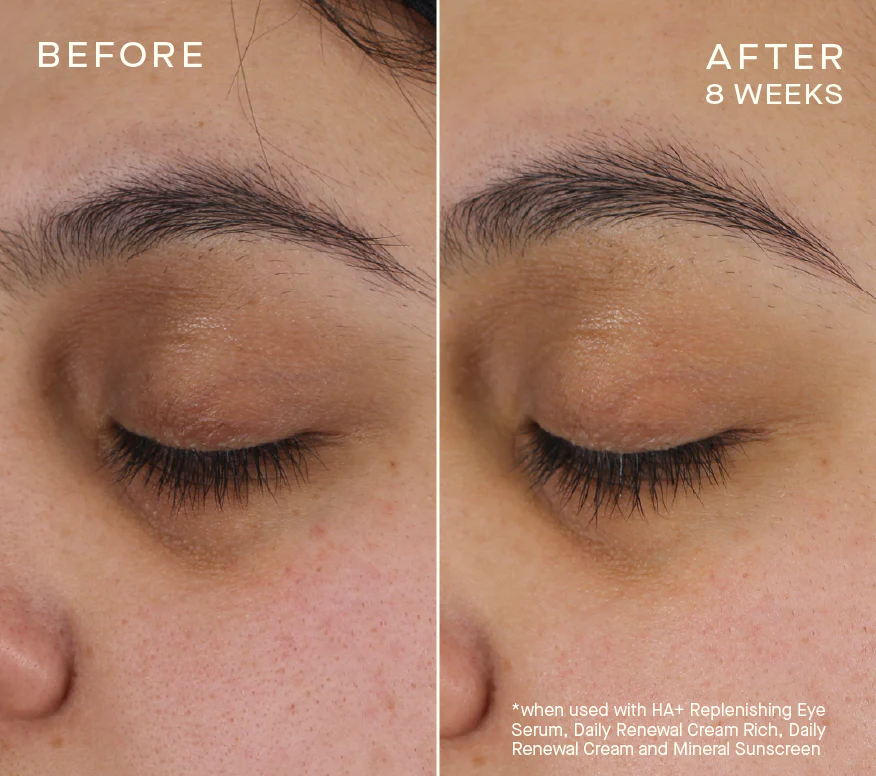 Advanced Regenerative Eye Serum