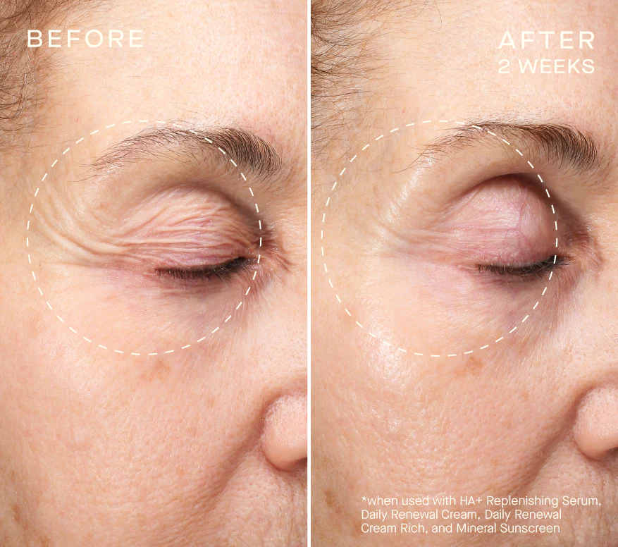 Advanced Regenerative Serum