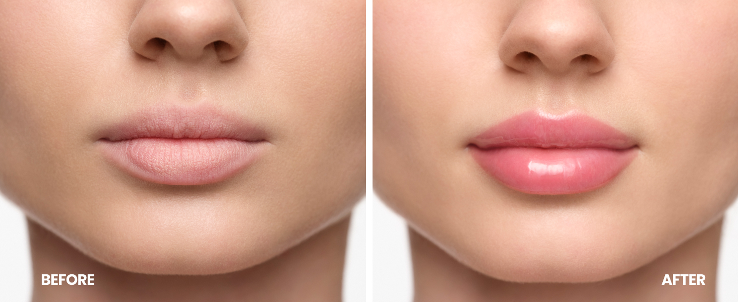 Wonderskin Lip Plumper Gloss
