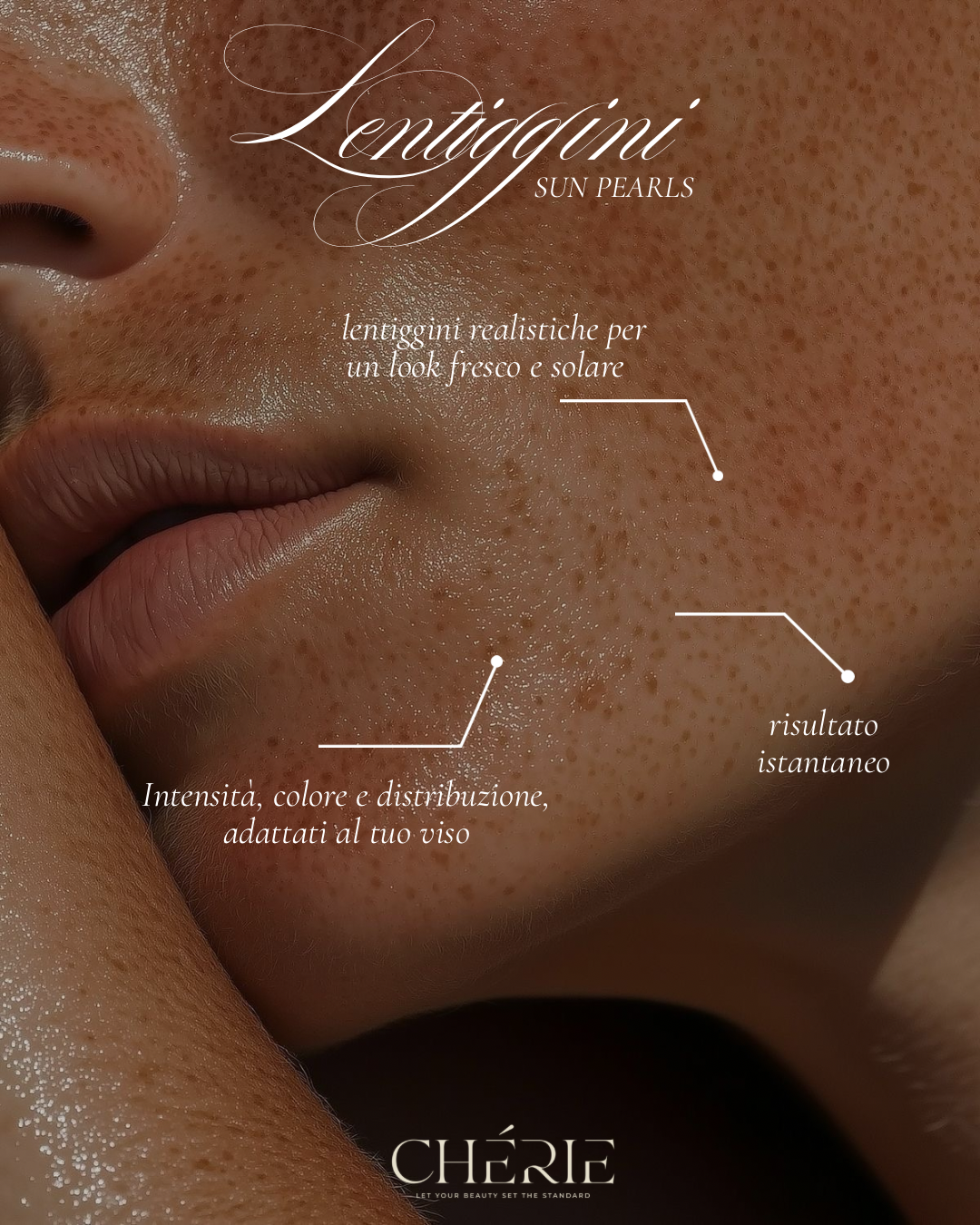 LENTIGGINI — Fleur Freckles