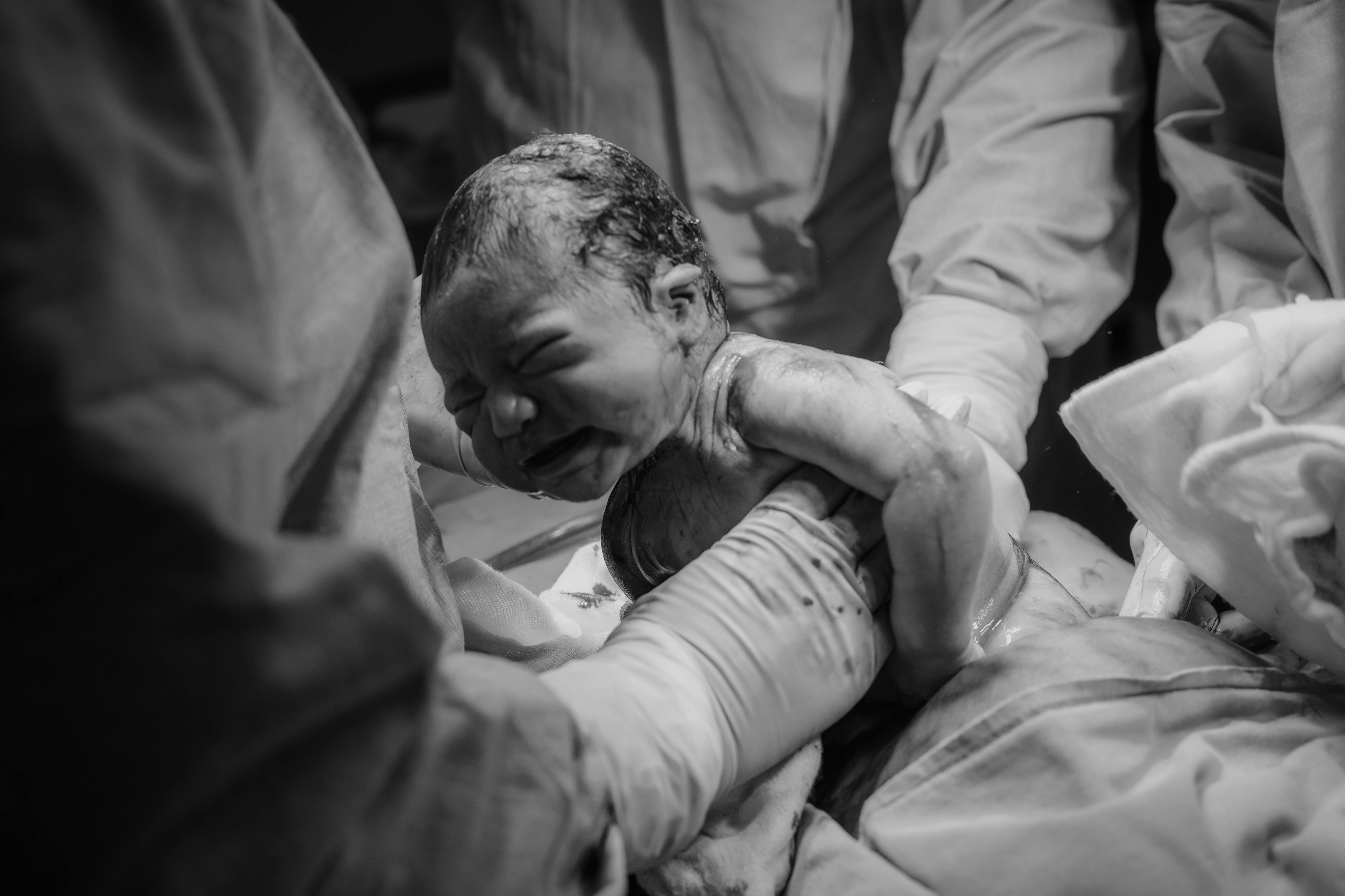 Doula Support Consultation 