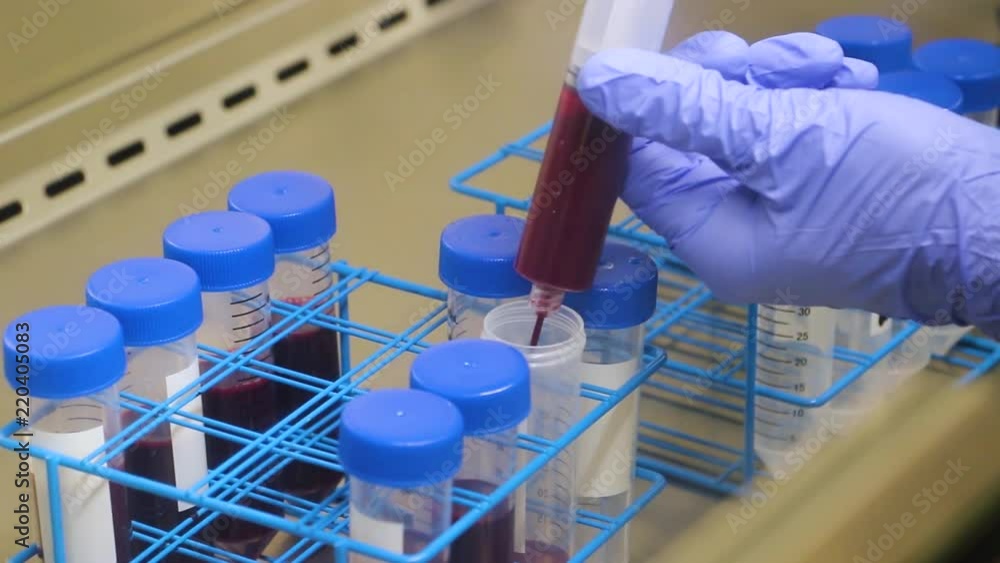 Healthy Human Whole blood