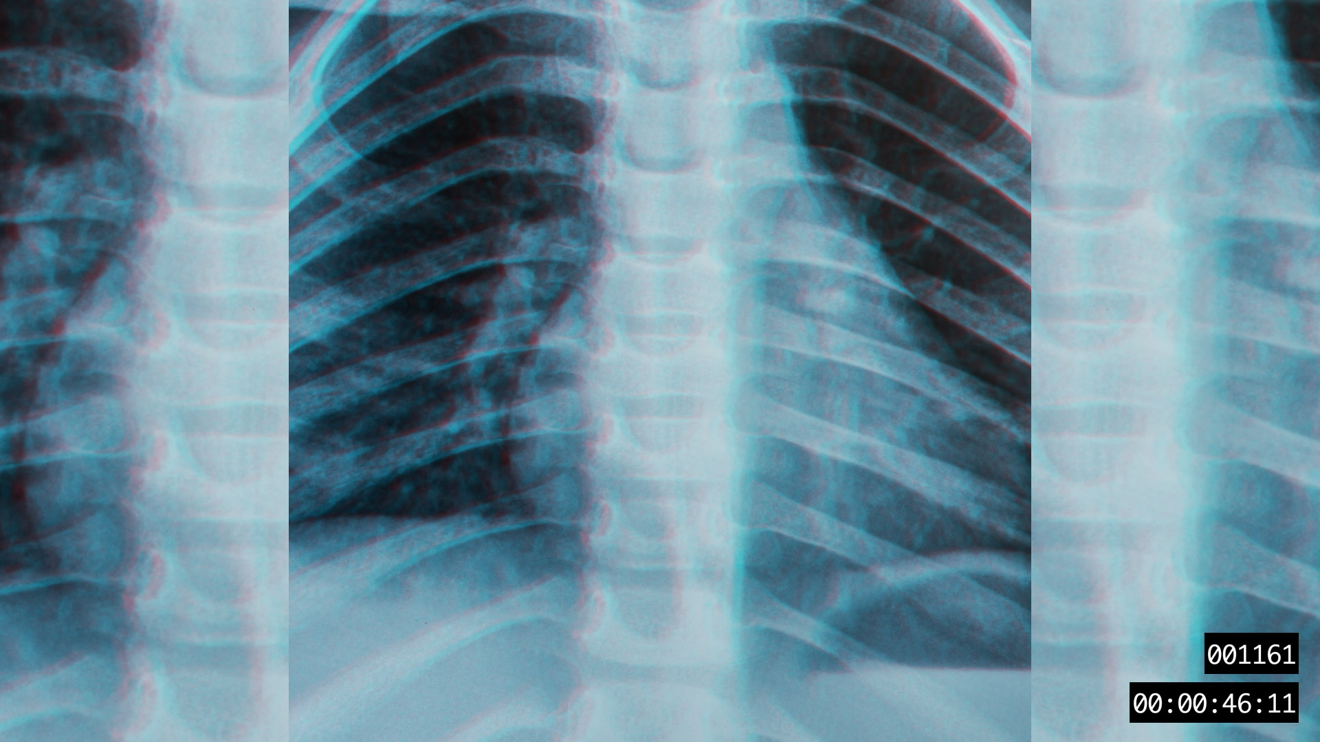 VIDEO-FRAGMENT 001161