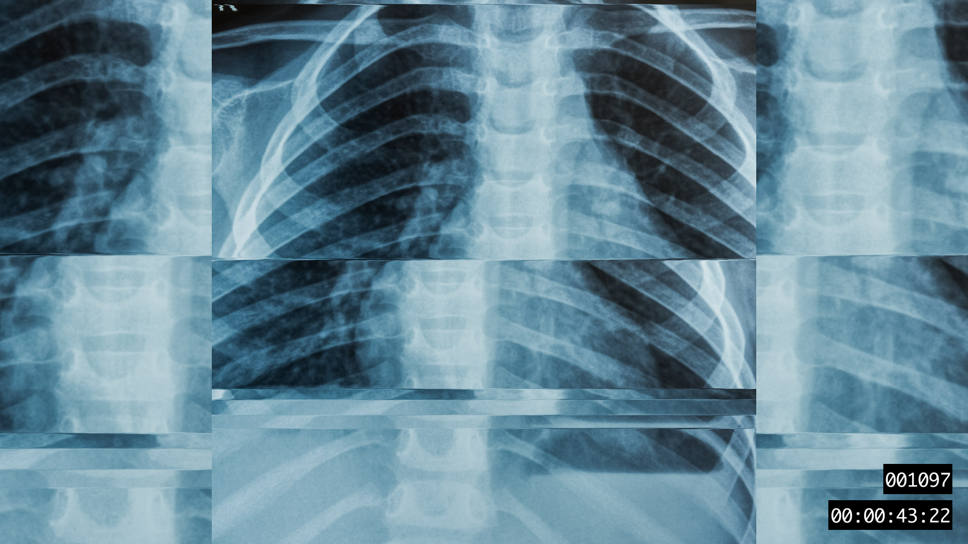 VIDEO-FRAGMENT 001097