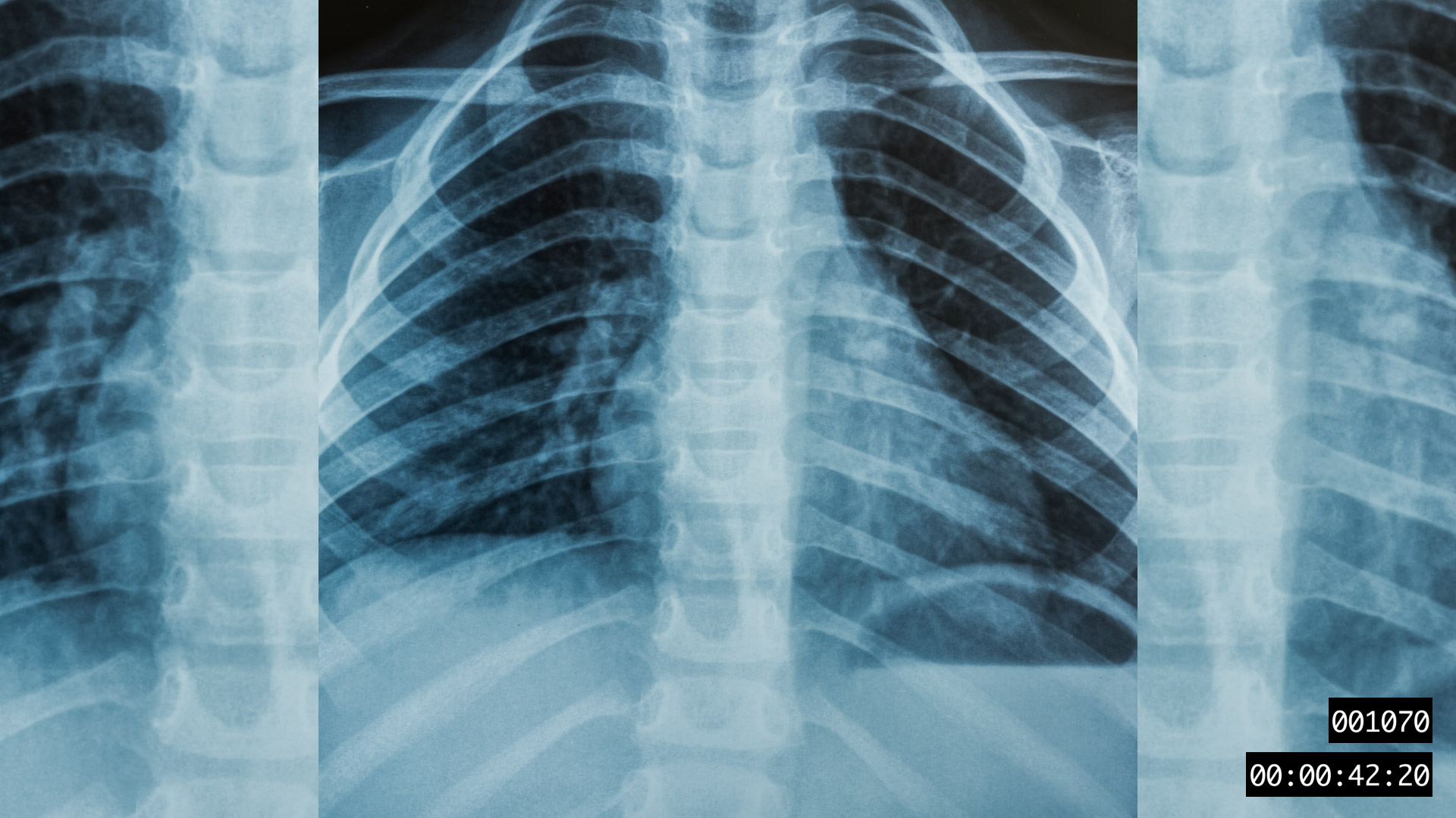 VIDEO-FRAGMENT 001070