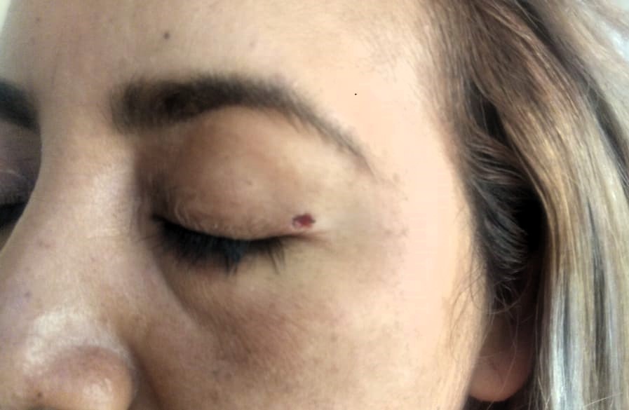 Tratamientos Estéticos