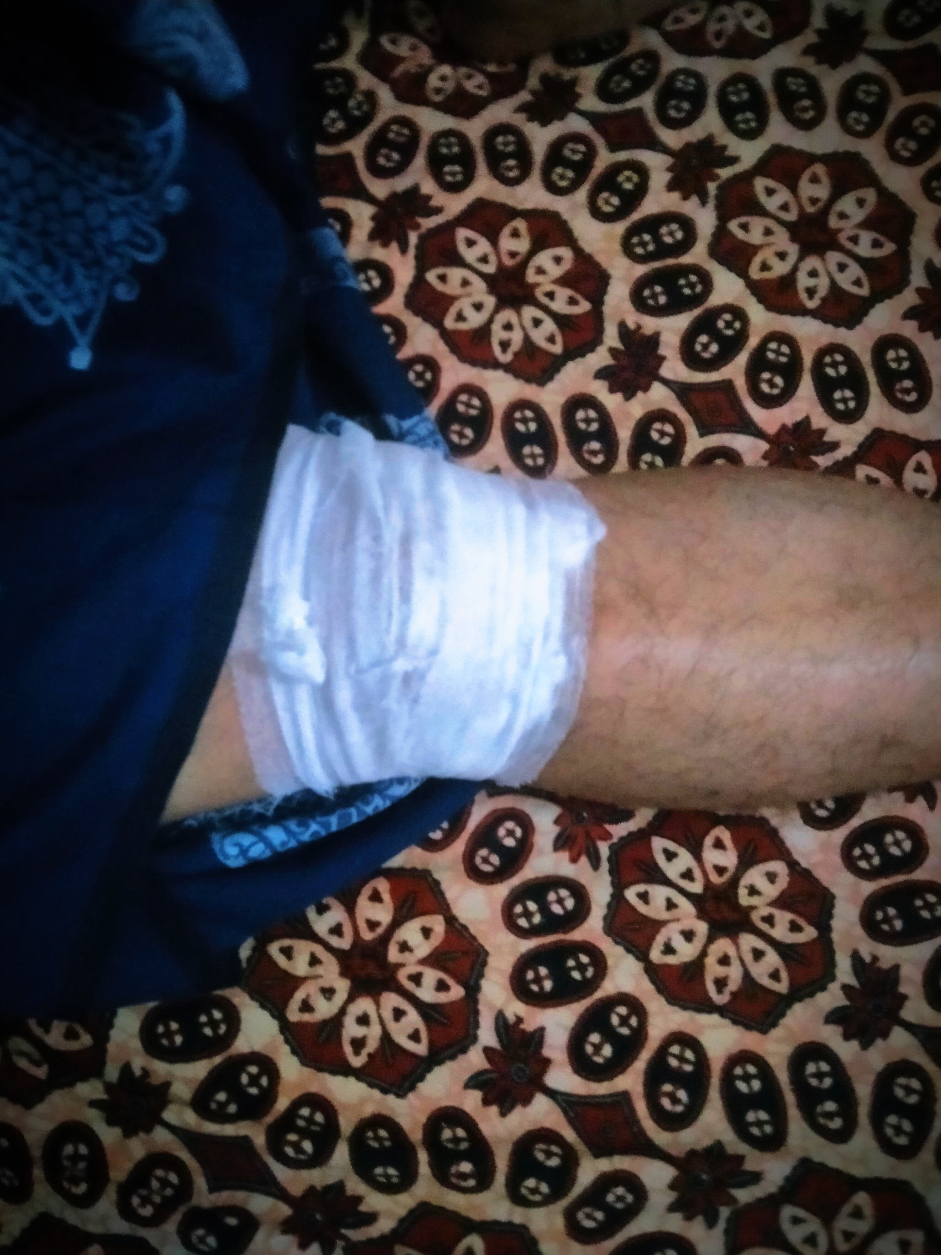 Digital Wound Care Guide