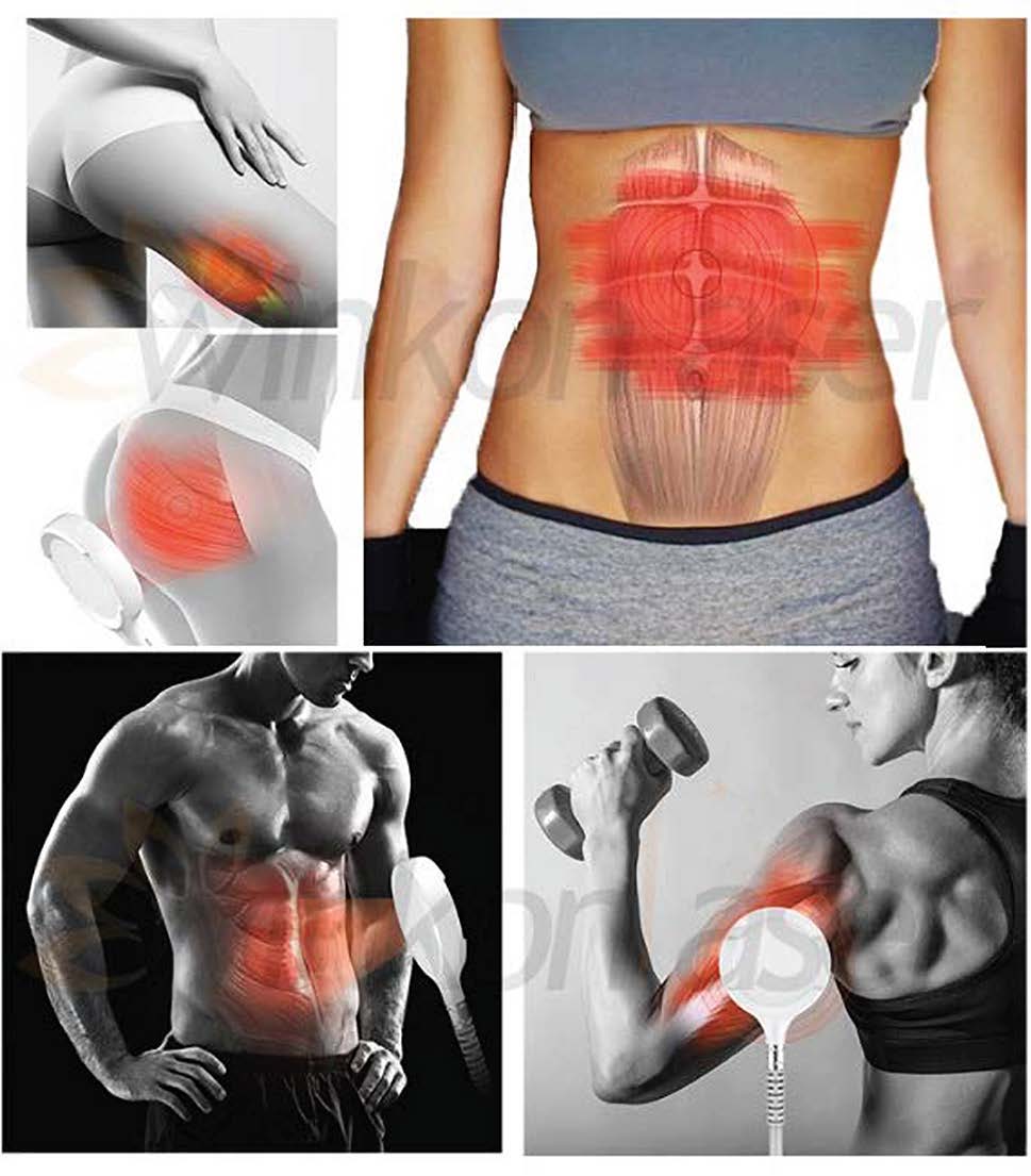 4er Paket HIFEM BodySculpting RF