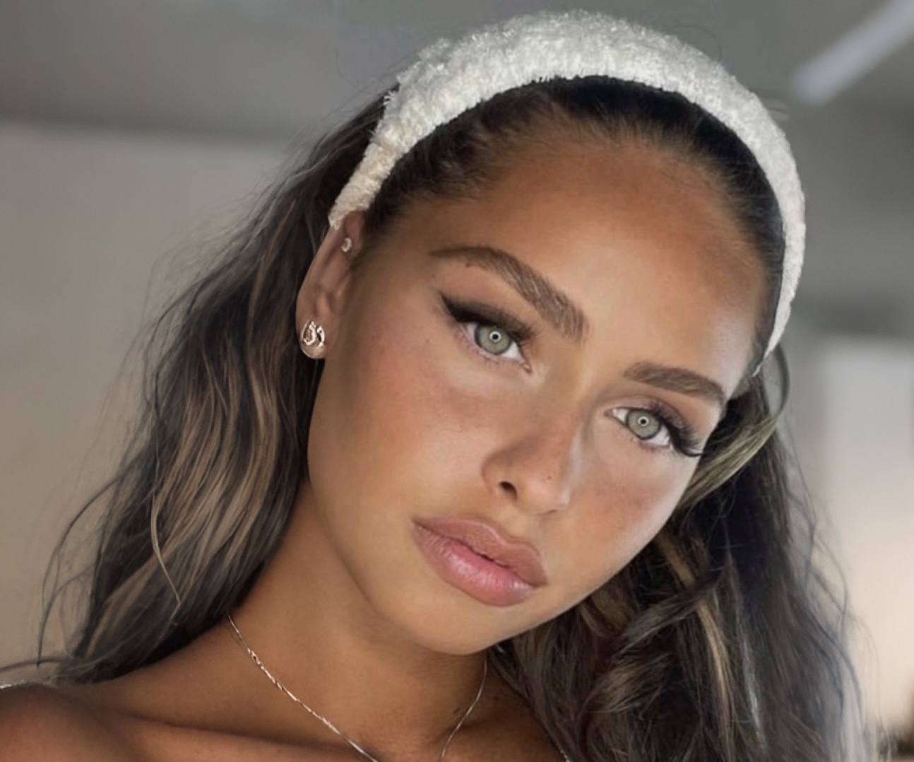 Brow Lift