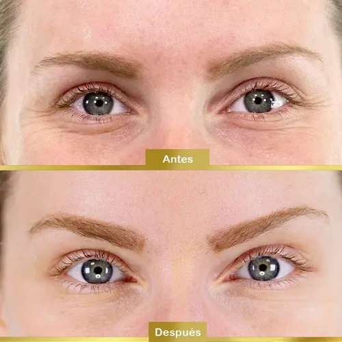 Parche de colágeno para  ojeras