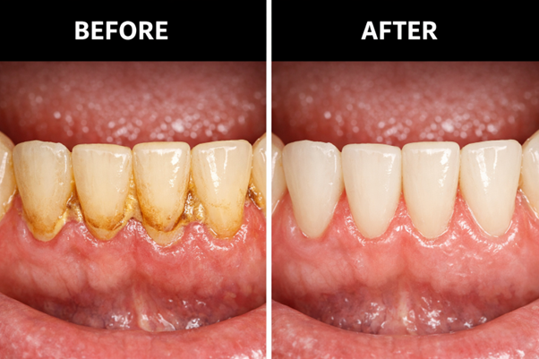 ULTRA SONIC CLEANING