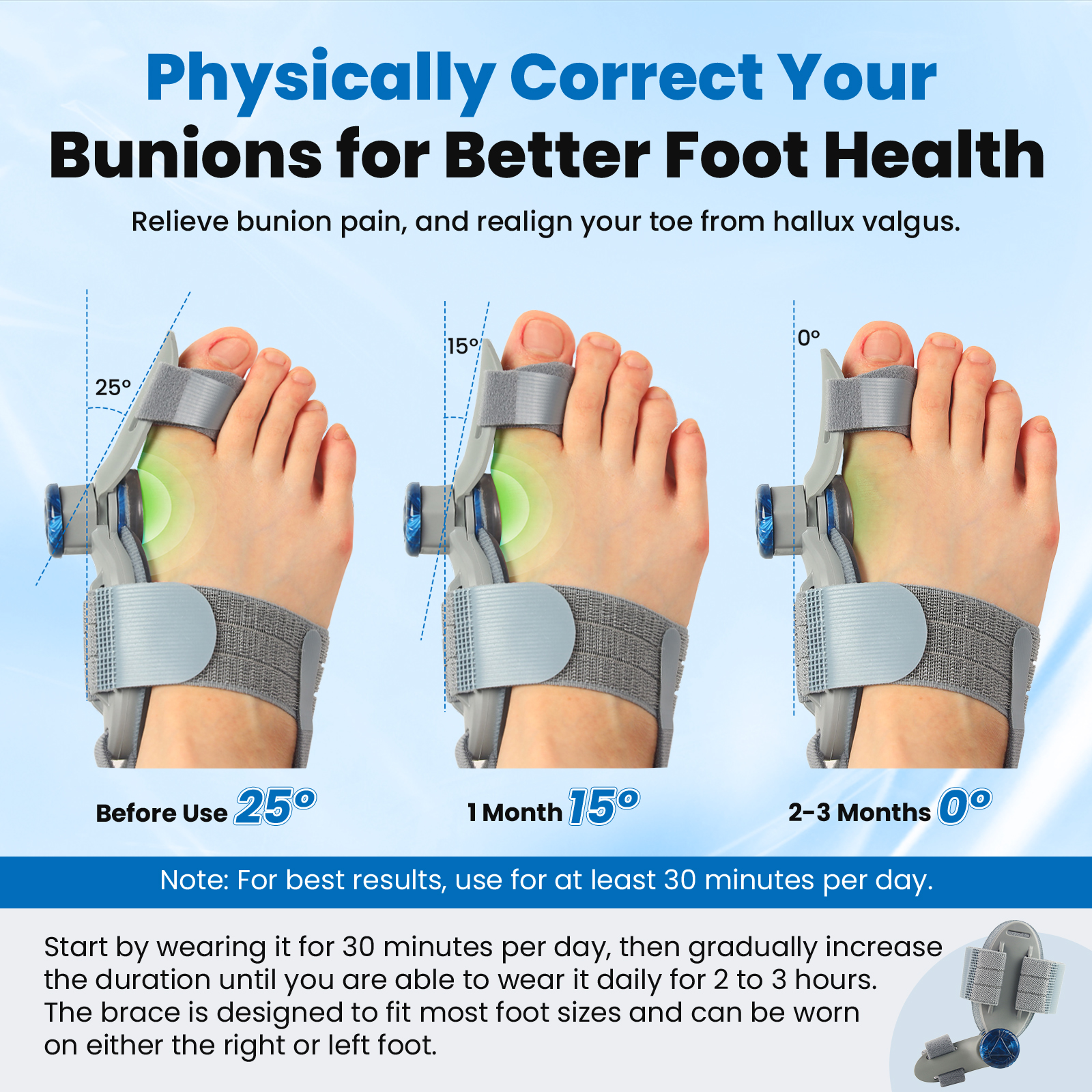SIMTAR Premium Adjustable Bunion Corrector for Woman – Big Toe Valgus Brace & Support Device Left & Right Foot Night Splint bunion fix without surgery