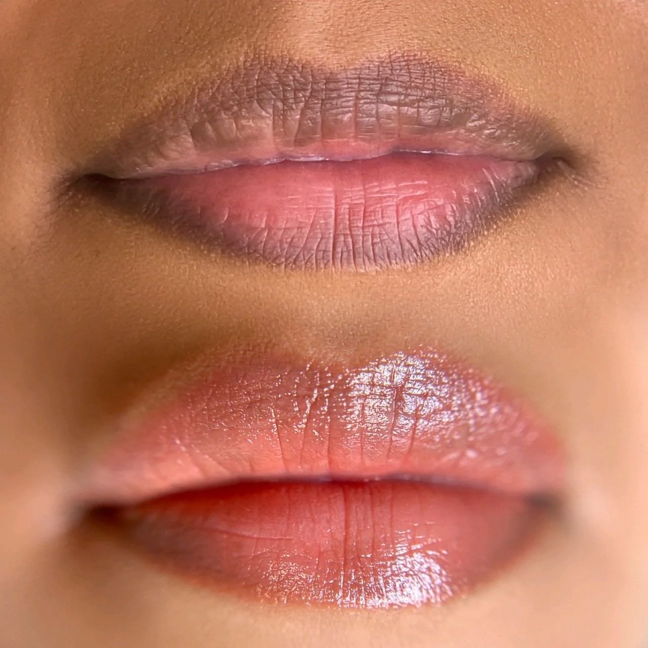 Lips Neutralization