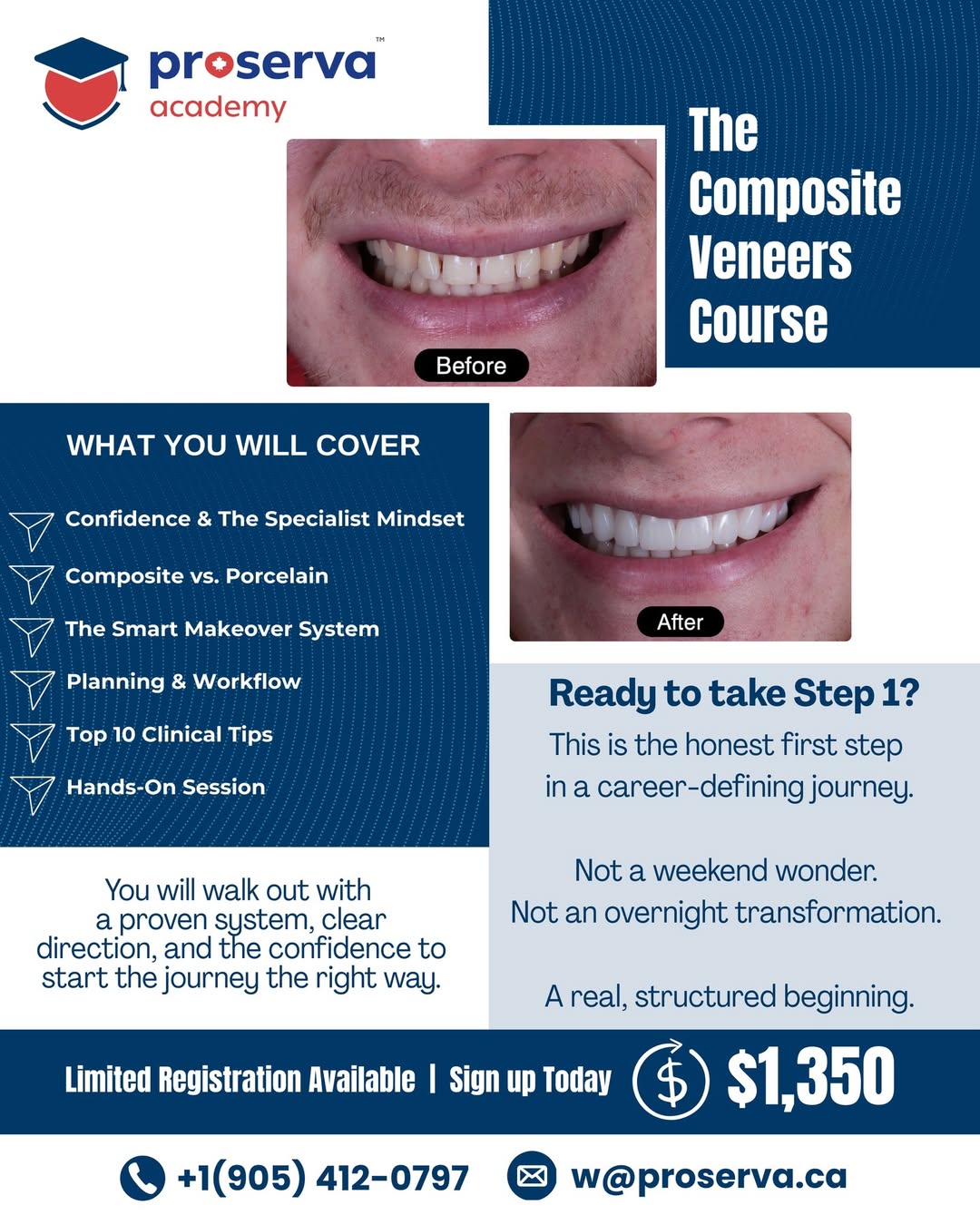 The Composite Veneers Course