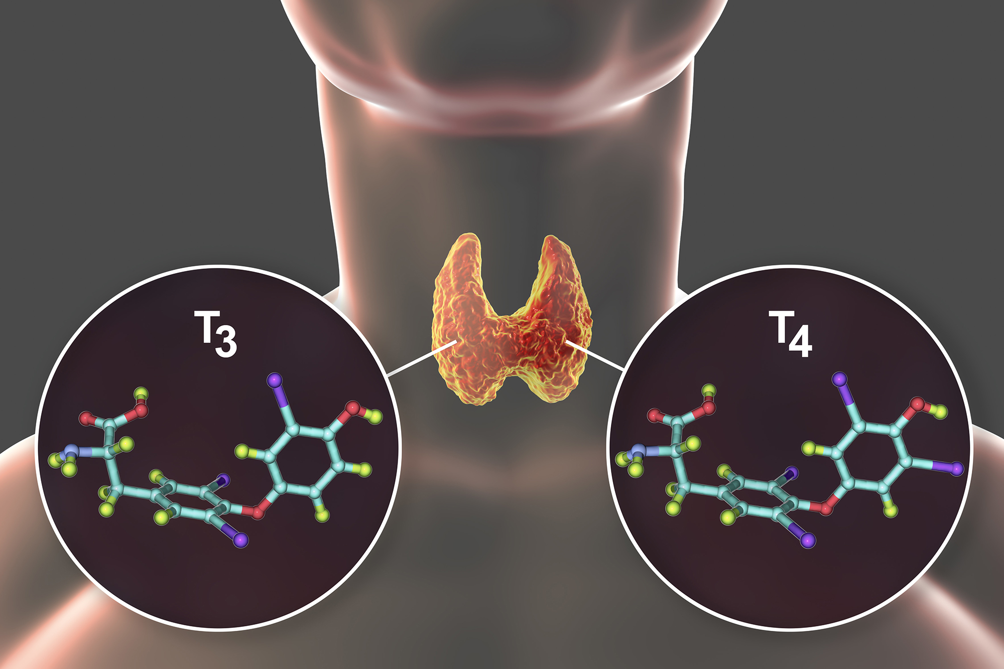 Thyroid Panel - Complete