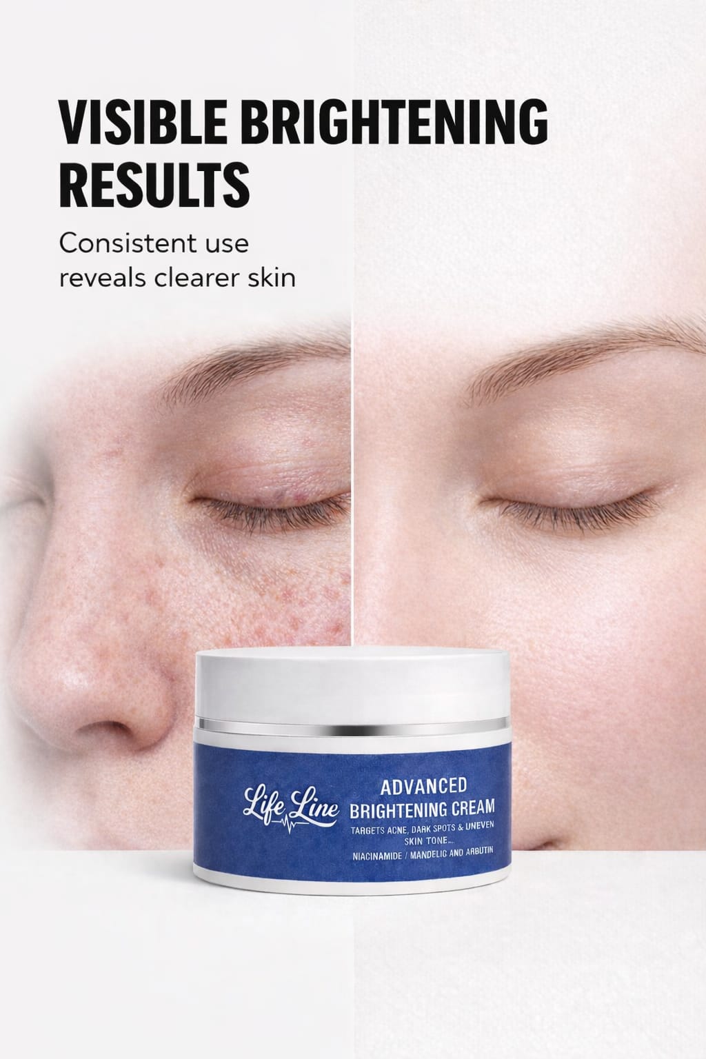 Life Line Advanced Brightening Cream