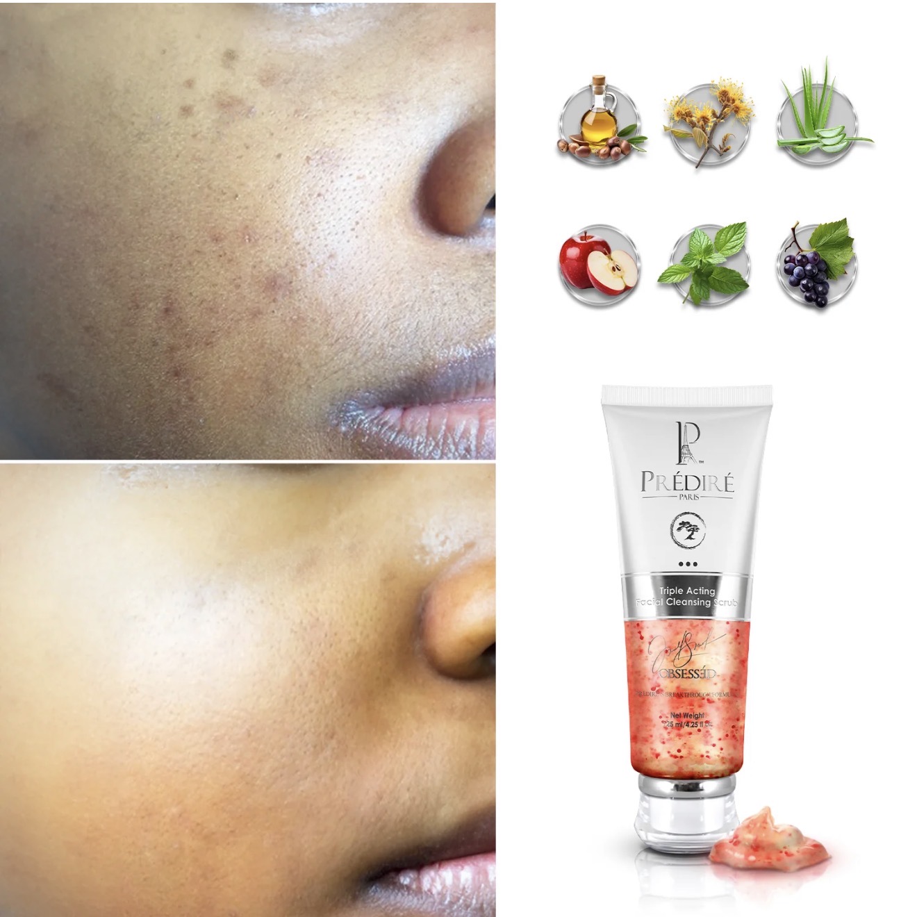 Triple Action Facial Cleansing Scrub + Apple & Grape Stem Cell Lip Mask Set