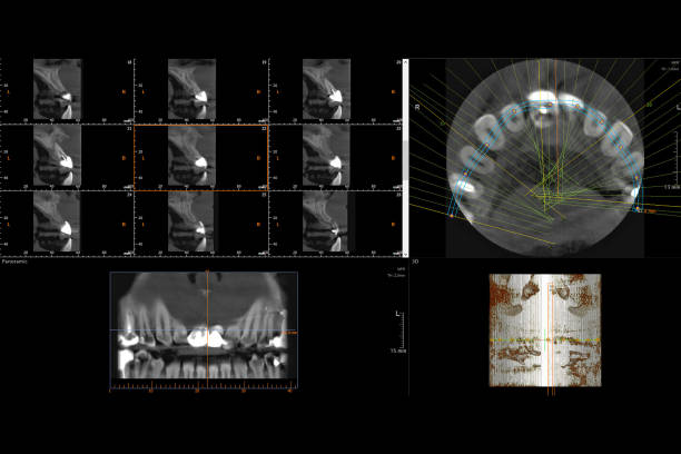 Precision CBCT Imaging