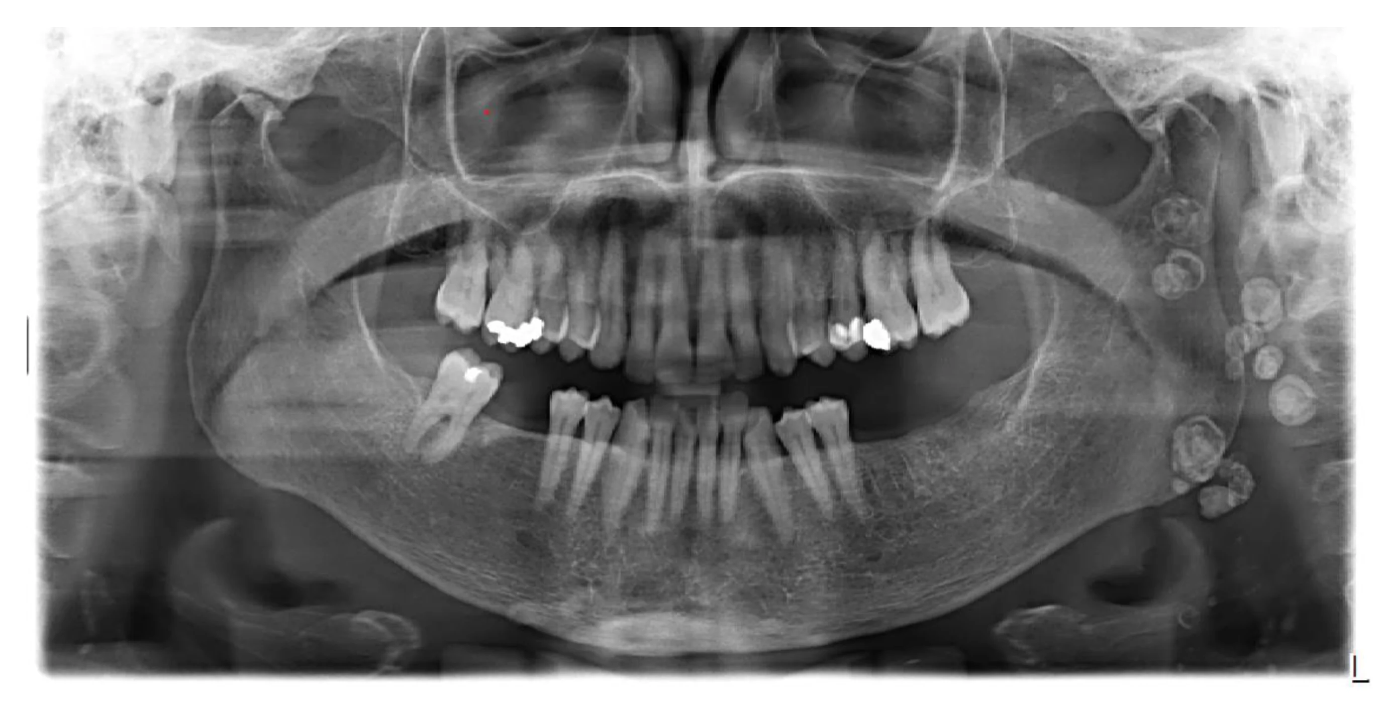 Smart OPG Imaging