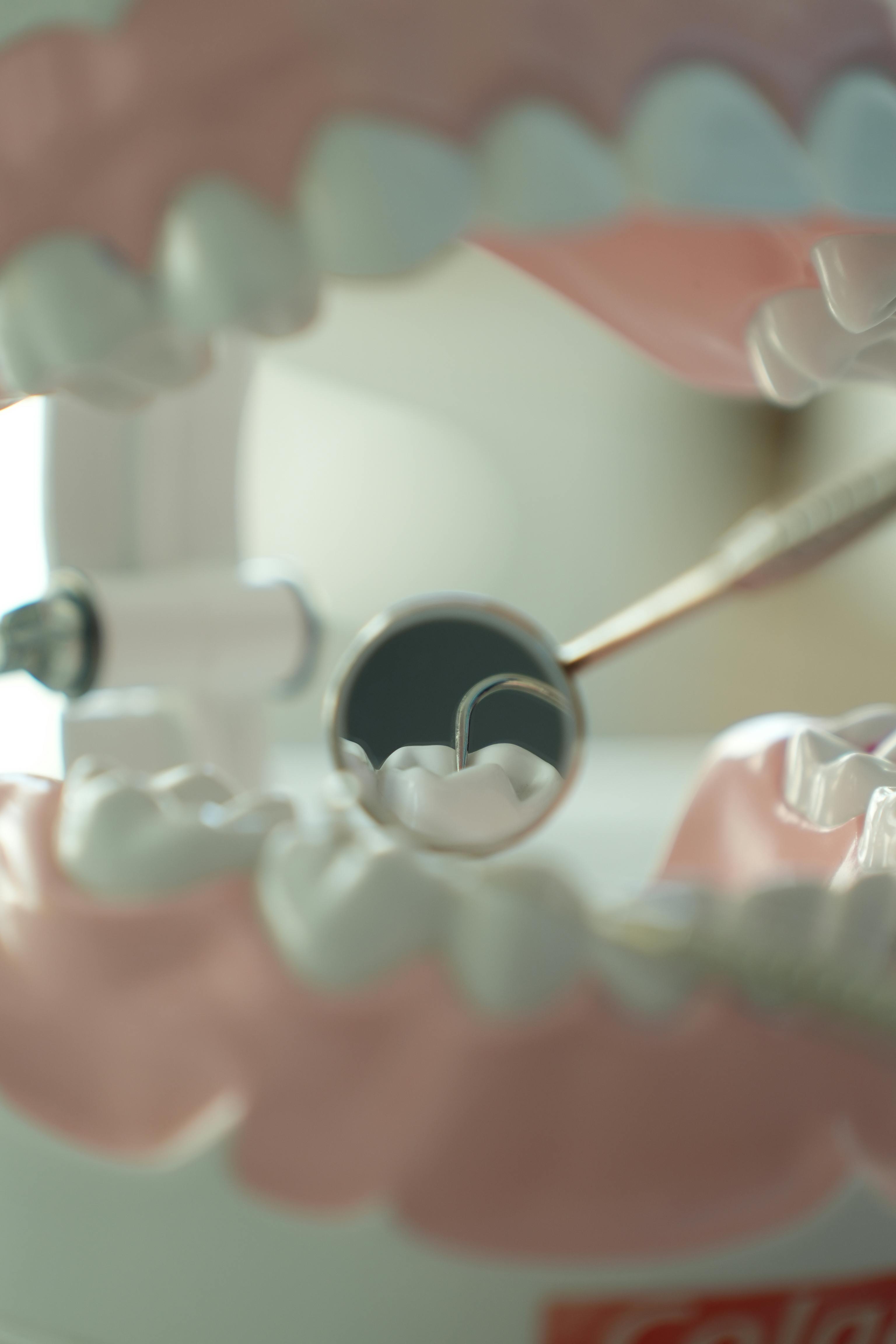 Smart OPG Imaging
