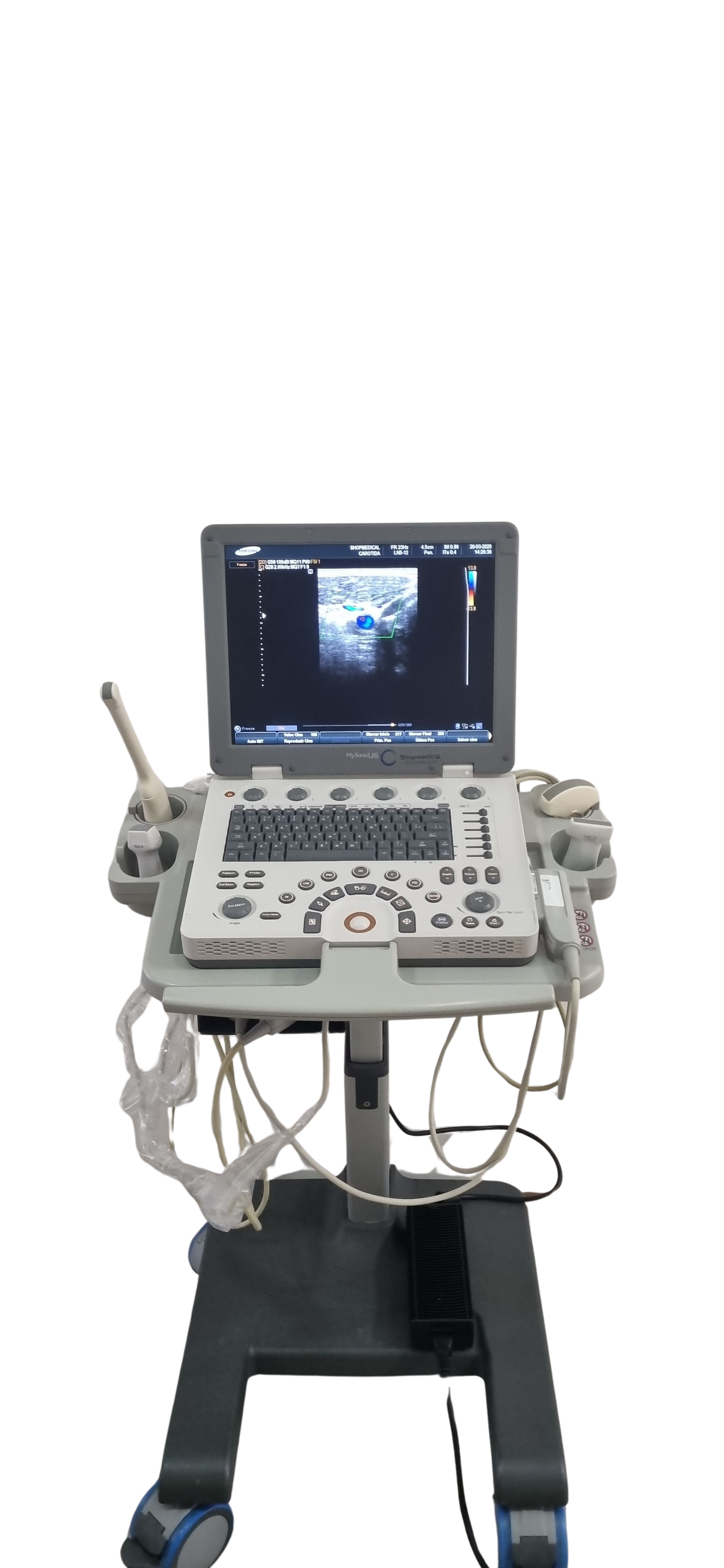 Portable Ultrasound Machine