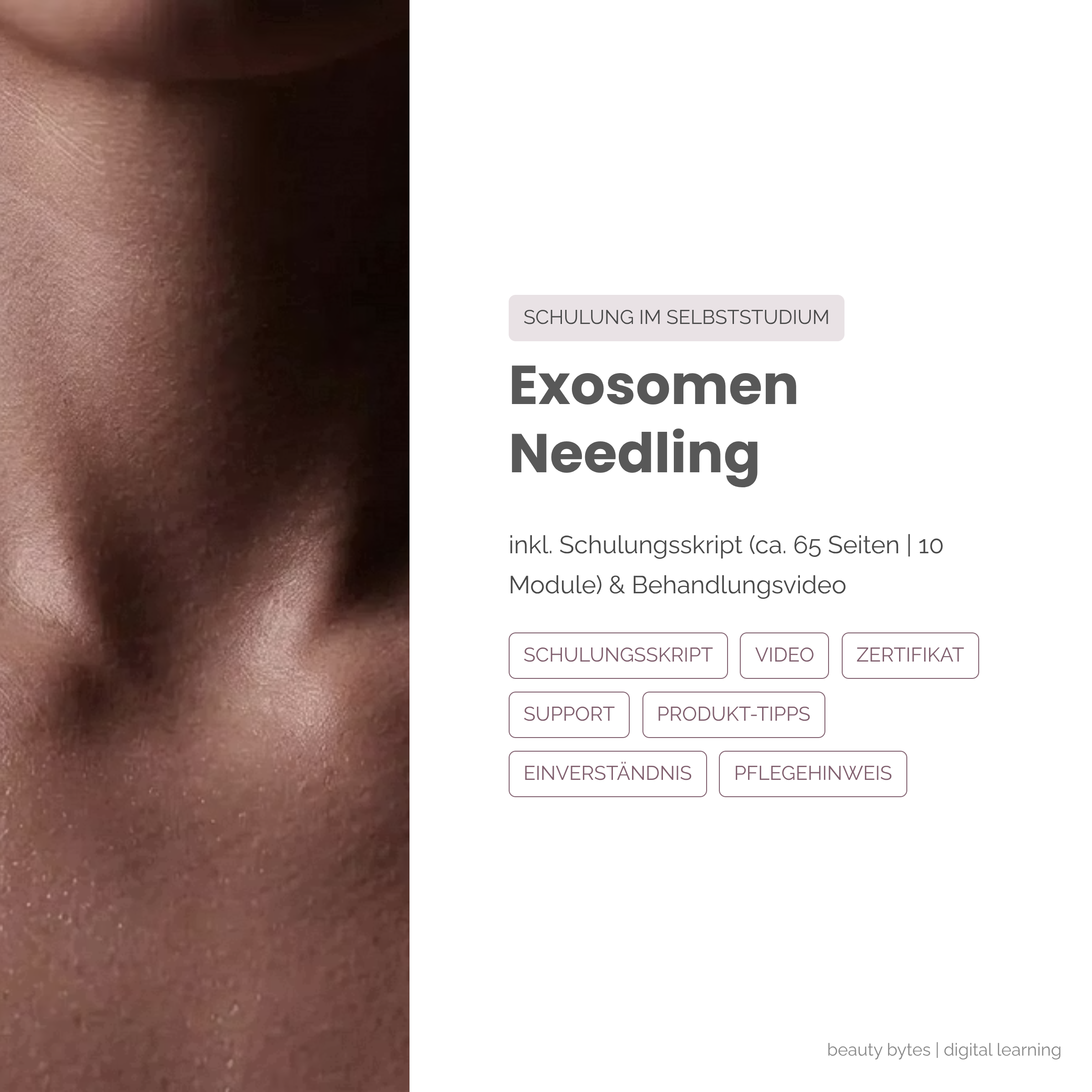 Exosomen Needling