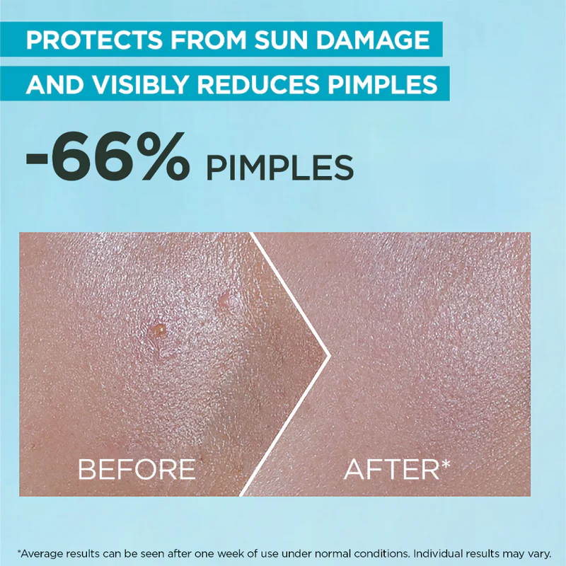 Garnier Super UV Anti-Acne SPF50+ Sunscreen 12H Oil Control 30ml