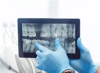 Digital X-Ray and Complete Denture 