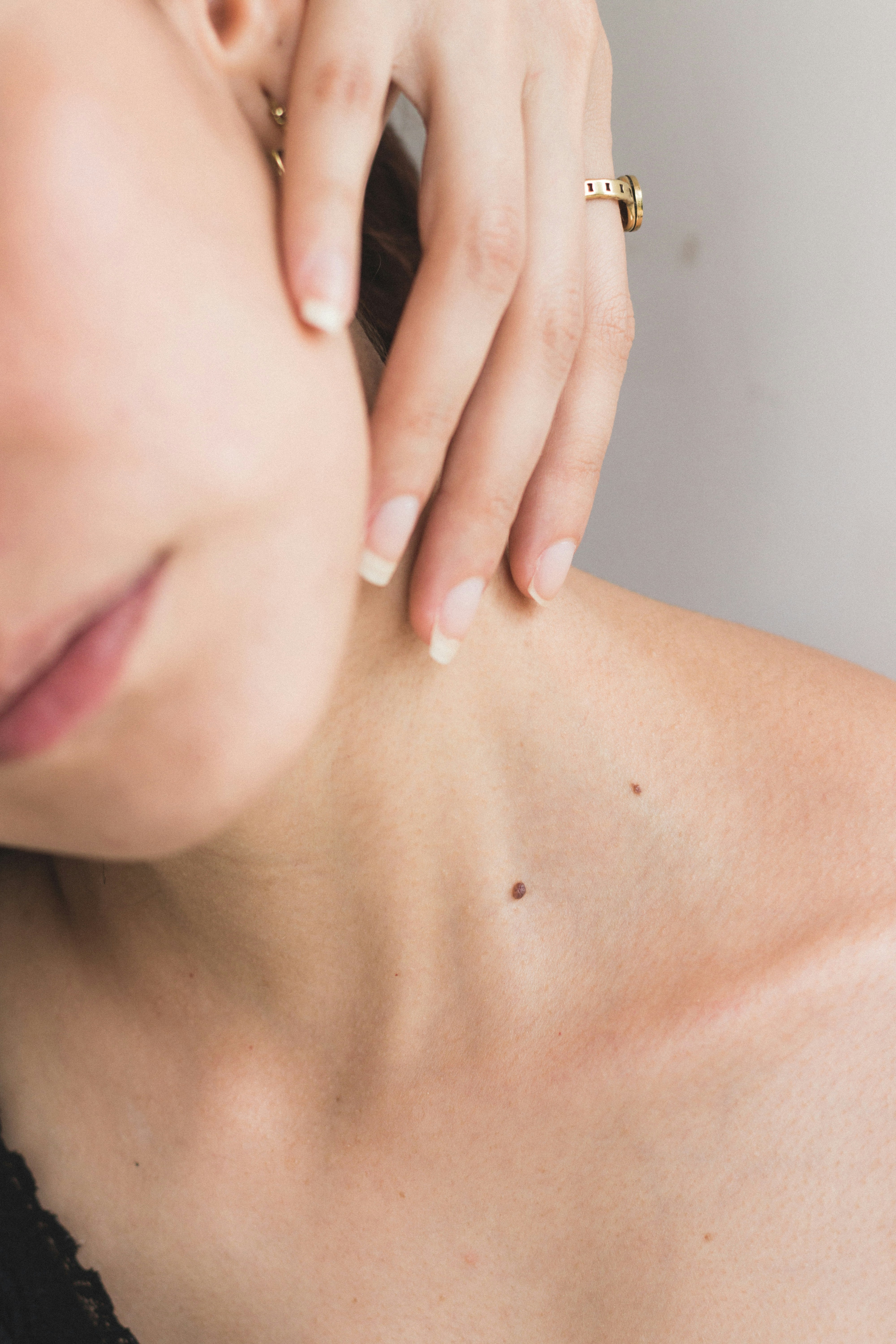 Neck Ultherapy: The Ultimate Non-Surgical Neck Lift